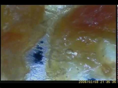 earwax in microscope - YouTube