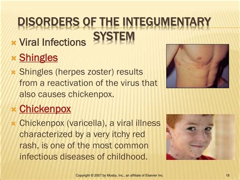 Diseases of the skin list