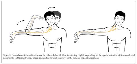 Upper Limb Tension Test Ulnar Nerve