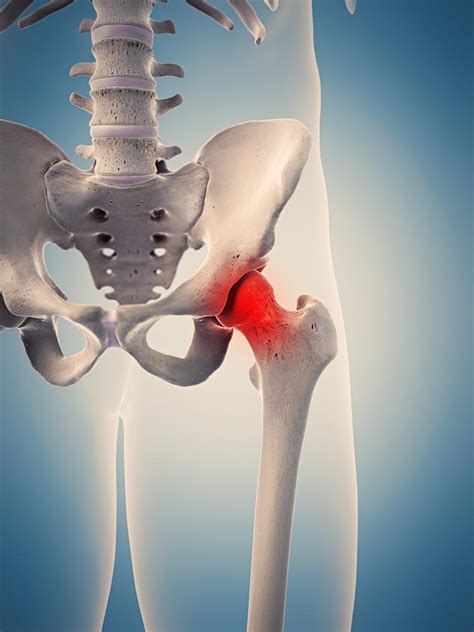 Harvard Health Publishing On Joint Injections | Pain Medicine located in Scottsdale, Mesa and ...