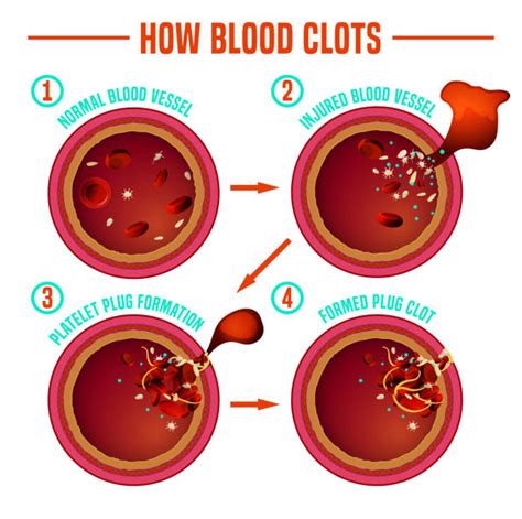 Platelets Illustrations, Royalty-Free Vector Graphics & Clip Art - iStock