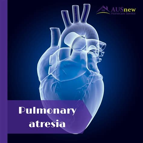 Pulmonary atresia symptoms and causes – Artofit