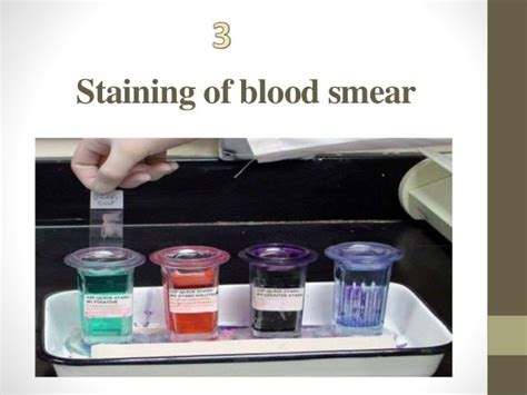 Blood smear staining