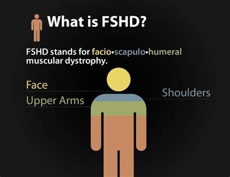 What is FSHD | Muscular dystrophies, How to raise money, Human genome