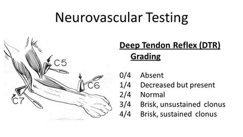 Image result for brachioradialis strength testing | Nervous system ...