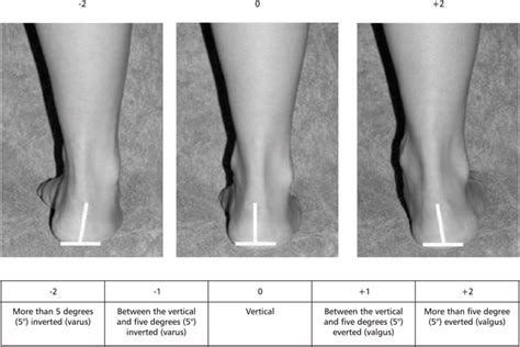 The evaluation of the inversion/eversion of the calcaneus | Download ...