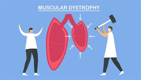 Muscular dystrophy is diseases 1229080 Vector Art at Vecteezy