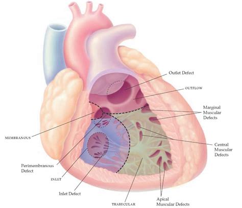 Pin on Heart Advocacy