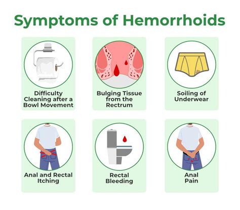 Hemorrhoids or Piles: Types, Symptoms, Cause & Treatment