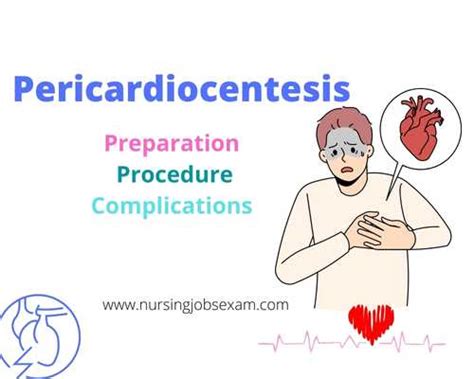 Pericardiocentesis: Preparation Procedure Complications - Nursing Jobs Exam