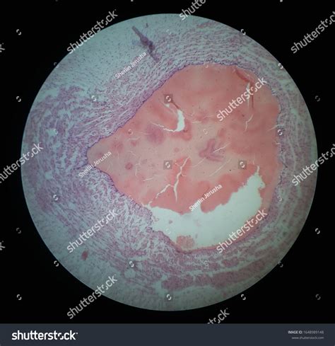 Histology Specimen Human Umbilical Cord Under Stock Photo 1648989148 ...