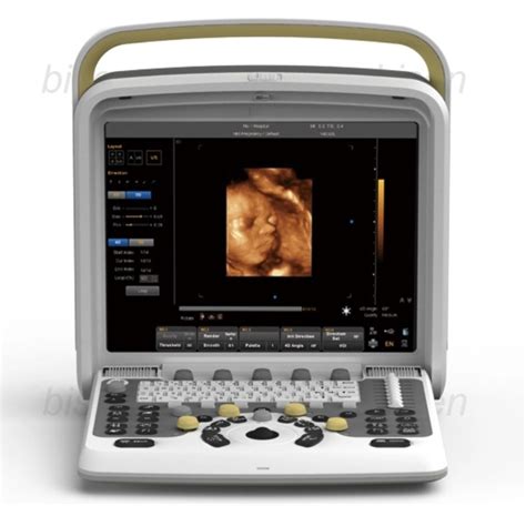 Chison Q5 Portable 3D/4D Color Doppler OB/GYN Ultrasound Machine at best price in Mumbai