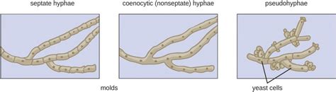 Mold: characteristics, types of hyphae and examples - Online Biology Notes