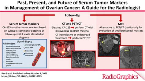 Ovarian Tumor Markers Table Gallery | Hot Sex Picture