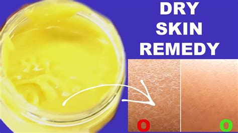 GET RID OF DRY FLAKY SKIN, EFFECTIVE REMEDY FOR DRY SKIN, GET SOFT SMOOTH SKIN INSTANTLY - YouTube