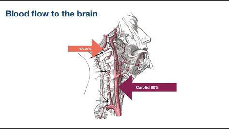 The Vertebral Artery Test Part II: Risk assessment of the cervical ...