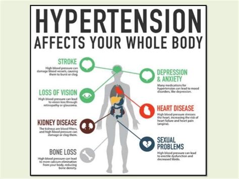 The Progression of Hypertensive Heart Disease.From hypertension to he…