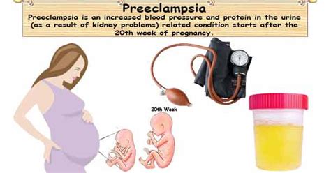 Preeclampsia, Superimposed Preeclampsia & Eclampsia