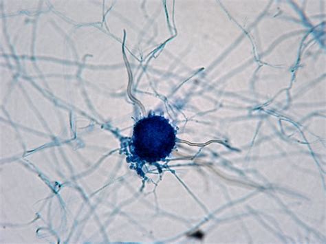 Fun With Microbiology (What's Buggin' You?): Chaetomium Species