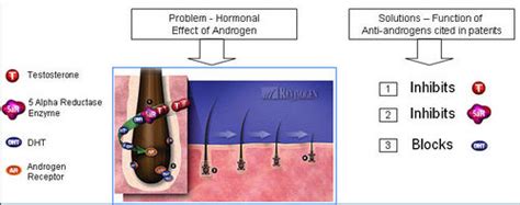 Antiandrogen and Hair Loss | What You Should Know