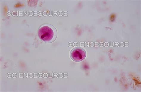 Photograph | Balantidium coli Cysts in Feces (LM) | Science Source Images