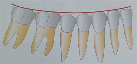 What you should know about: the occlusal plane and curve of Spee curve of Wilson O que você já ...