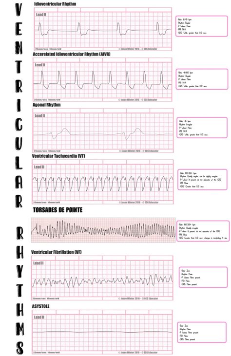 EKG Need to Knows/ Nursing/ EMT Paramedic/ Cardiology - Etsy