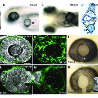 | Cell organization and behavior during choroid fissure fusion. (A ...