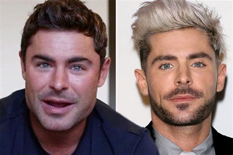 Did Zac Efron Get Plastic Surgery?