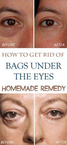 This 60-second Lymph Drainage technique reduces bags under your eyes and reduces jowls. You look ...