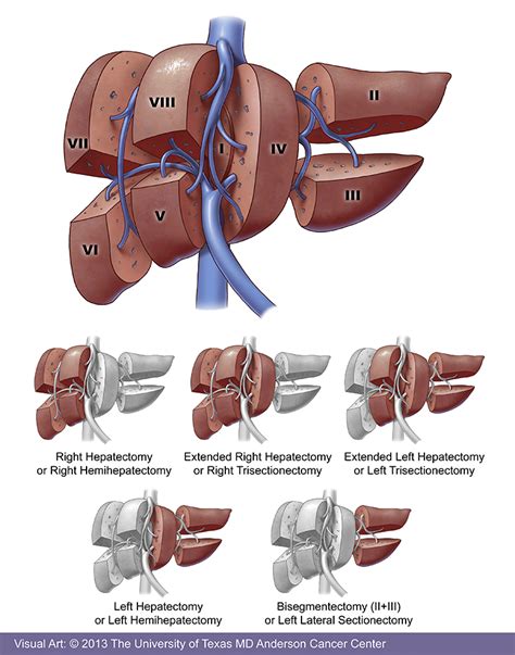 Liver Cancer Treatment Options