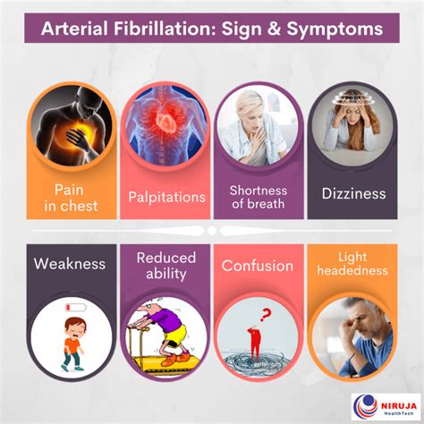 Arterial Fibrillation: Sign & Symptoms