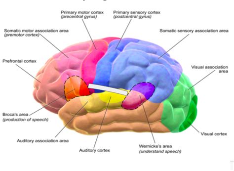 Aphasia Neurology Medbullets Step, 50% OFF