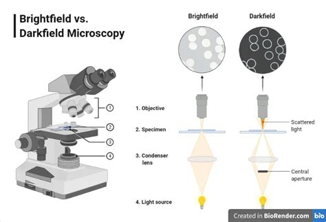 Dark-field Microscopy Is Often Used to Detect Which Bacterial Shape - DillankruwMorton