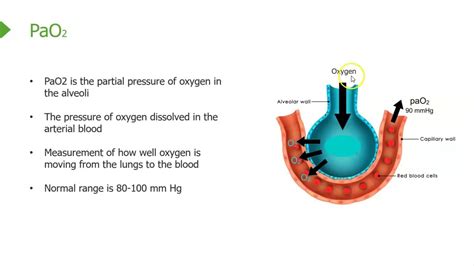 Understanding PaO2 FiO2 Ratio: Not all PaO2's are the same! - YouTube