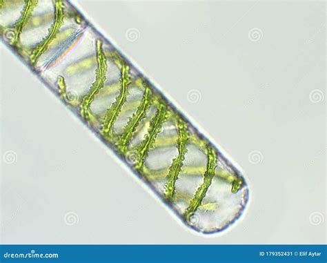 Spirogyra Sp. Algae Under Microscopic View X40 - Chlorophyta Stock Image - Image of microscope ...