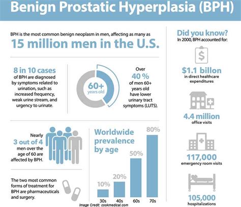 Prostate Enlargement - Symptoms, Causes & Treatment