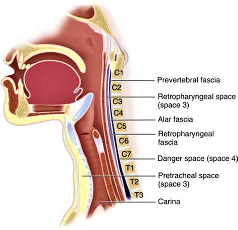 Retropharyngeal abscess causes, symptoms, diagnosis, treatment & prognosis