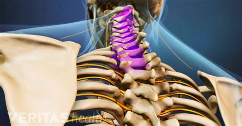 Cervical Spondylosis and Cervical Myelopathy Symptoms