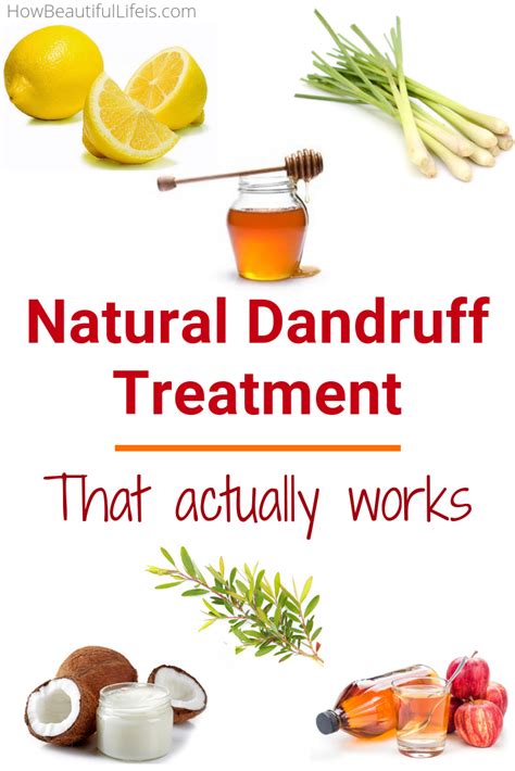 Natural Dandruff Treatment | How Beautiful Life Is