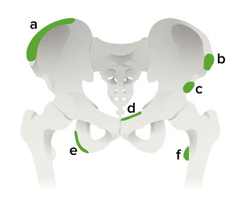 Apophyseal Avulsion Fracture | Concise Medical Knowledge