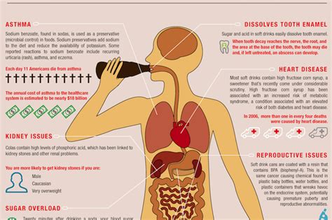 Infographics: Unhealthy Impact Of Drinking Soda | Boomers Daily