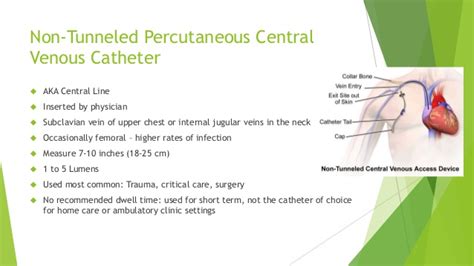 Superb tips for Tunneled Central Venous Catheter CPT codes - Medical Coding Guide