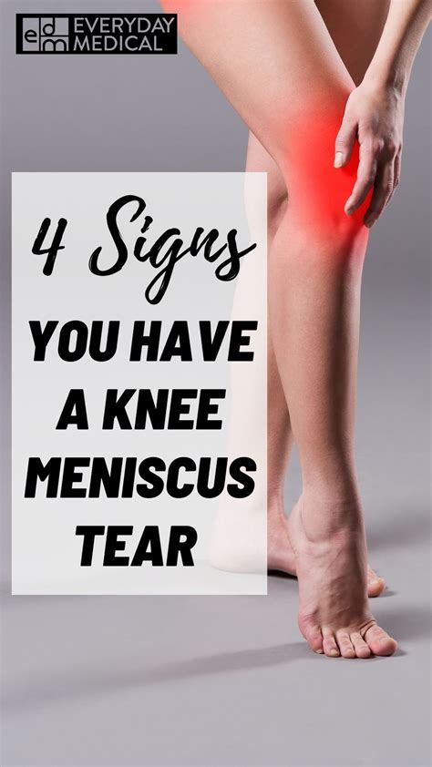 Meniscus tear symptoms and recovery – Artofit