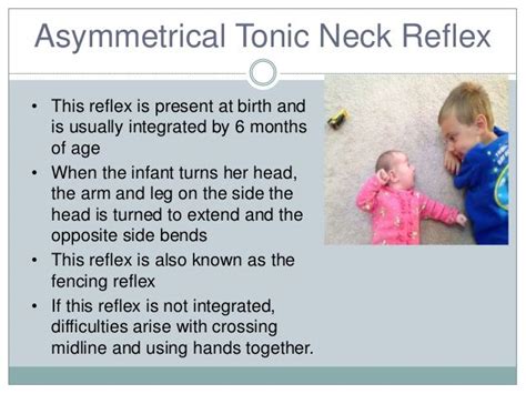 Tonic Neck Reflex | Tonic, Pediatrics, Nurse