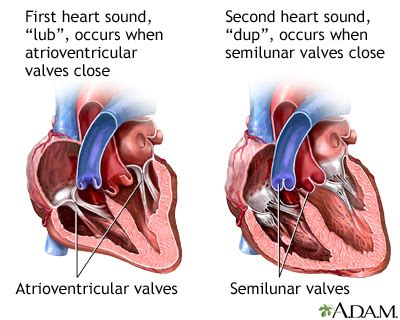 Heart beat: MedlinePlus Medical Encyclopedia Image