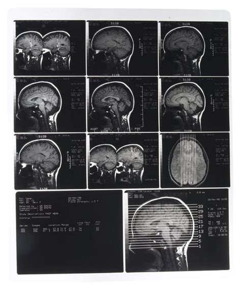 Examples of Radioisotopes in Biology | Education - Seattle PI