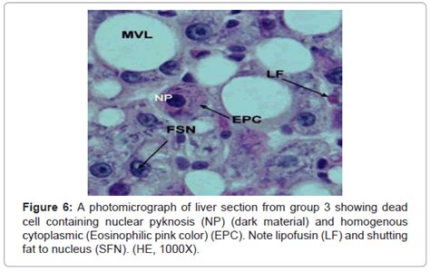 cytology-histology-a-photomicrograph-nuclear-pyknosis