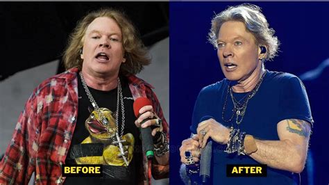 Axl Rose Weight Loss 2023. Diet, Workout, Voice, And Meme.