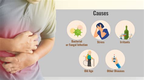 Chronic Gastritis : What Is It, Causes, Symptoms, Diagnosis, And More